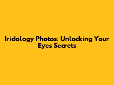 Iridology Photos: Unlocking Your Eye's Secrets